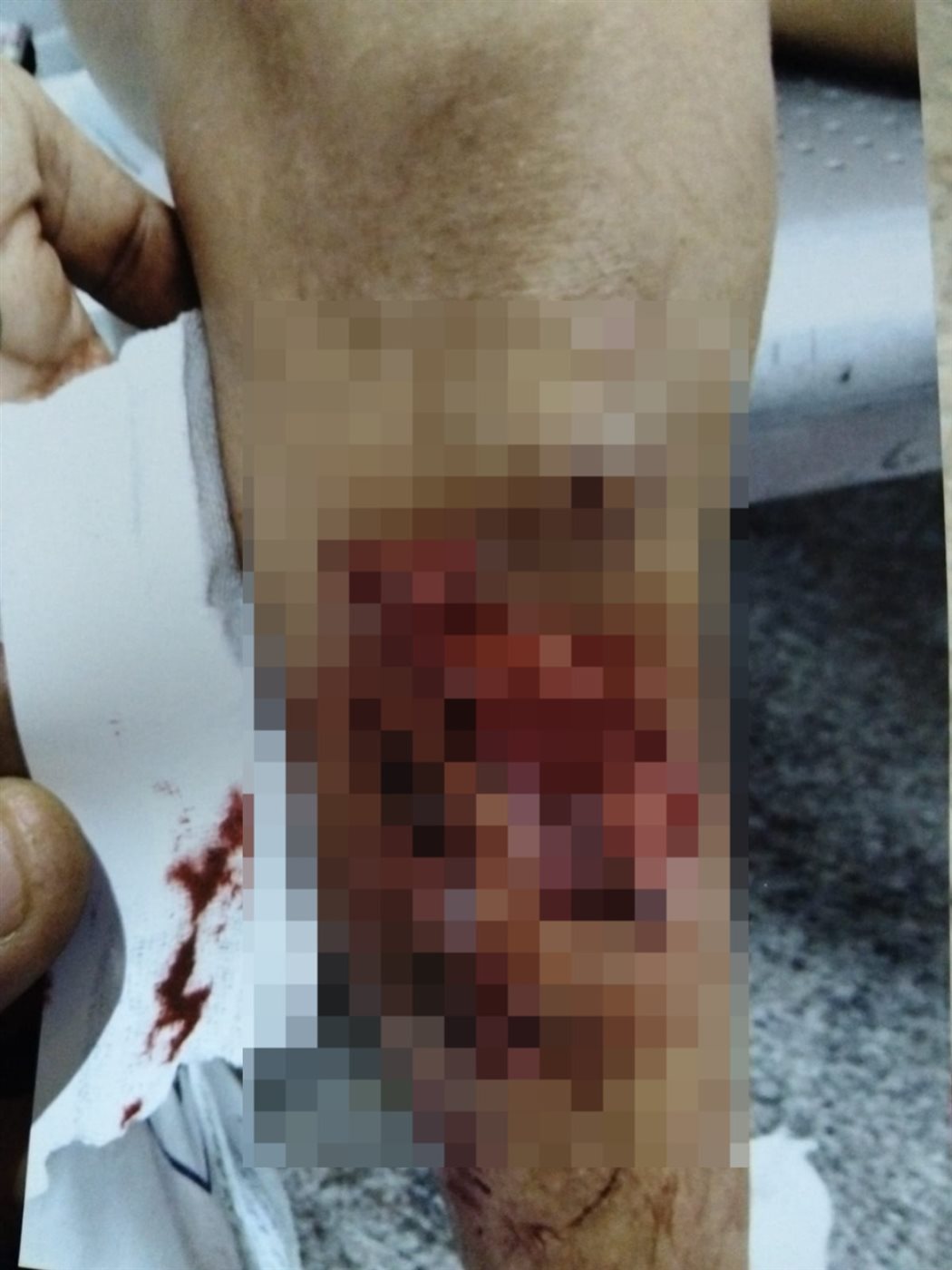  كلب شرس يعقر صغير في فخذه بالسلام 