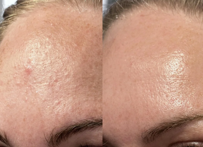 السيدة المُستخدمة للروتين