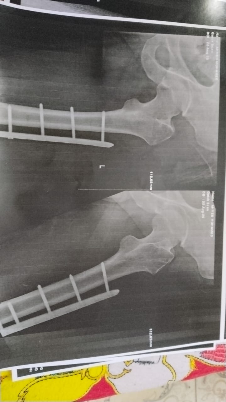 تقرير طبي لأحد مصابي حادث أسيوط 