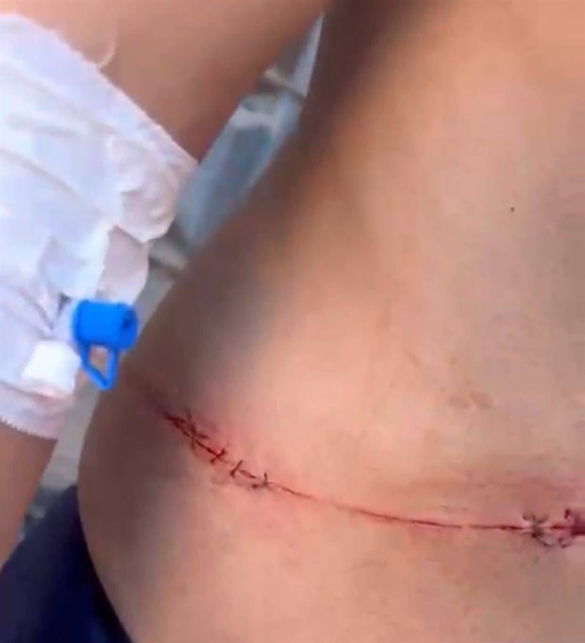 اعتداء 5 شباب على طالب ثانوي أمام مدرسته بالدقهلية