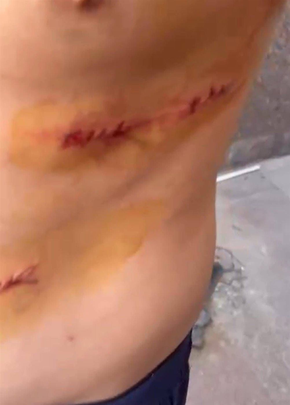 اعتداء 5 شباب على طالب ثانوي أمام مدرسته بالدقهلية