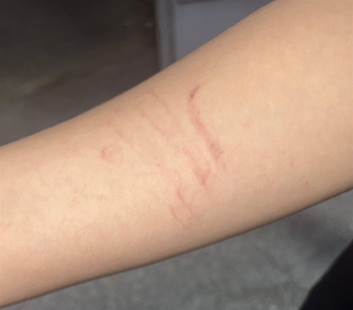 جانب من ضرب المعلمة