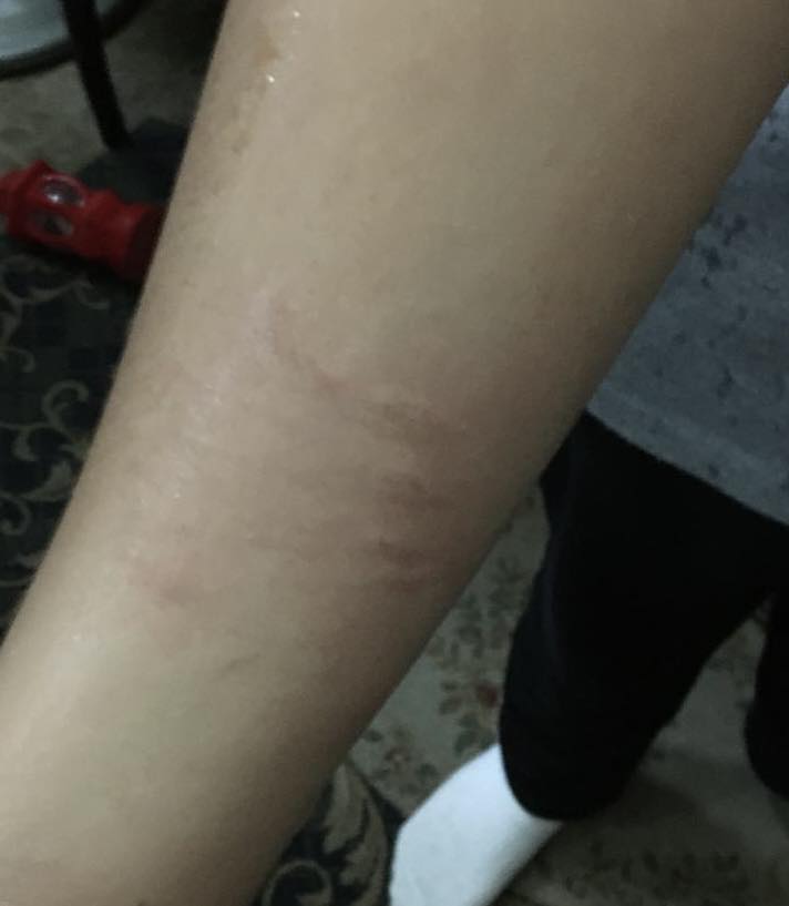 جانب من ضرب المعلمة