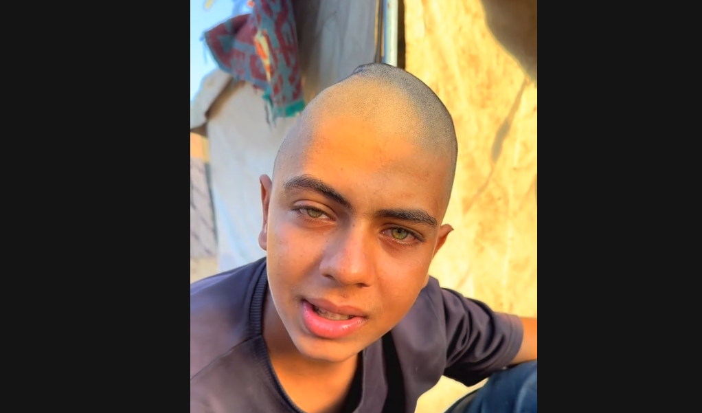 شاب فلسطيني يستغيث: إيدي الشمال مشلولة ونفسي حد يوفر ليا المسكنات لغاية ما أعمل العملية