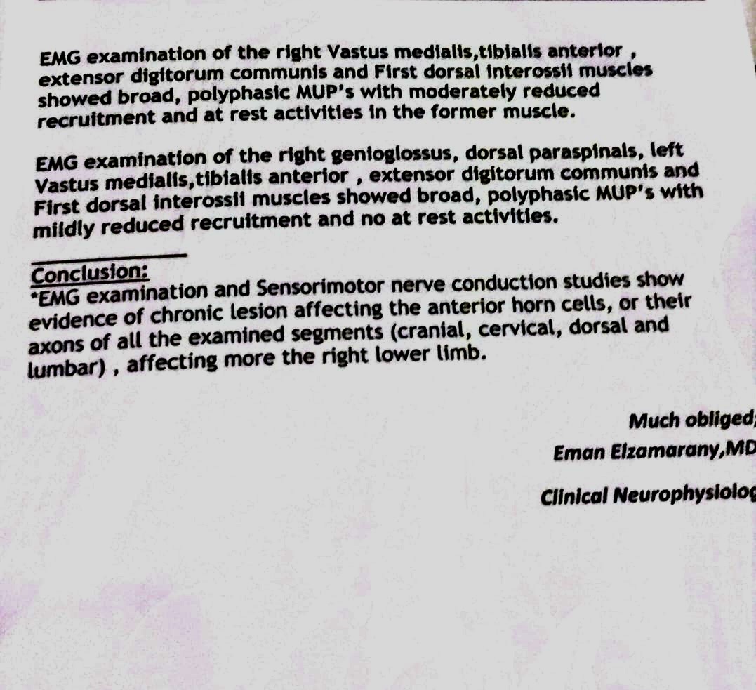 ضمور العضلات يهاجم الشاب محمود وأسرته تستغيث