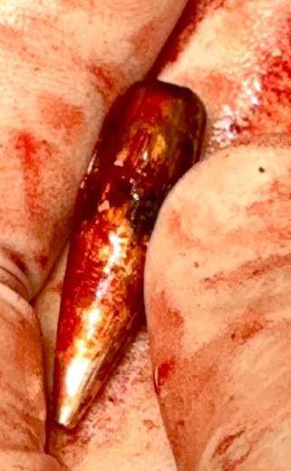 الطلقة التي تم استخراجها 