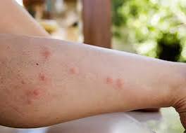 دورة حياة الذبابة