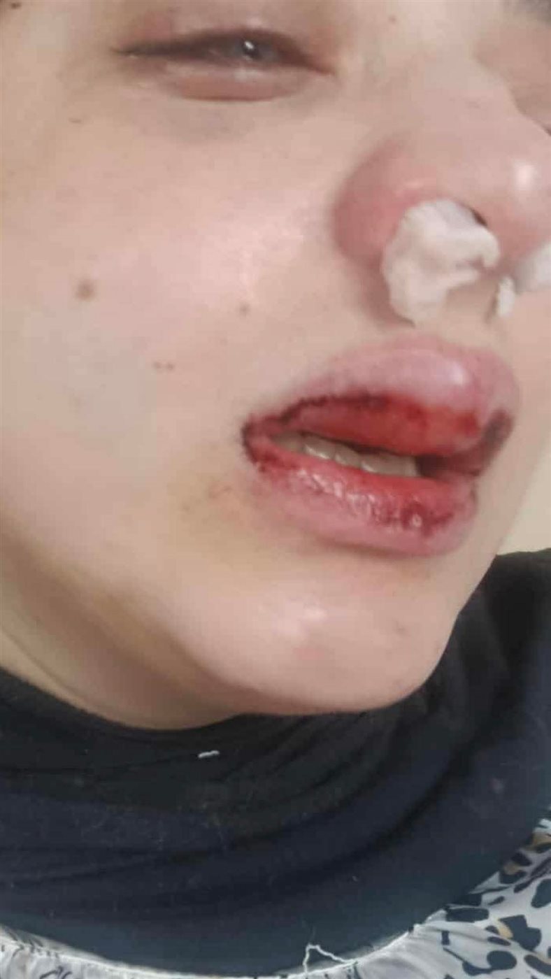 الاعتداء على سيدة ببورسعيد 