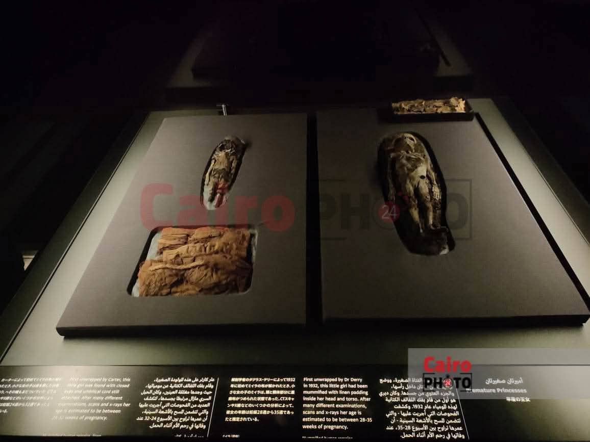 أجنة بنات توت عنخ آمون