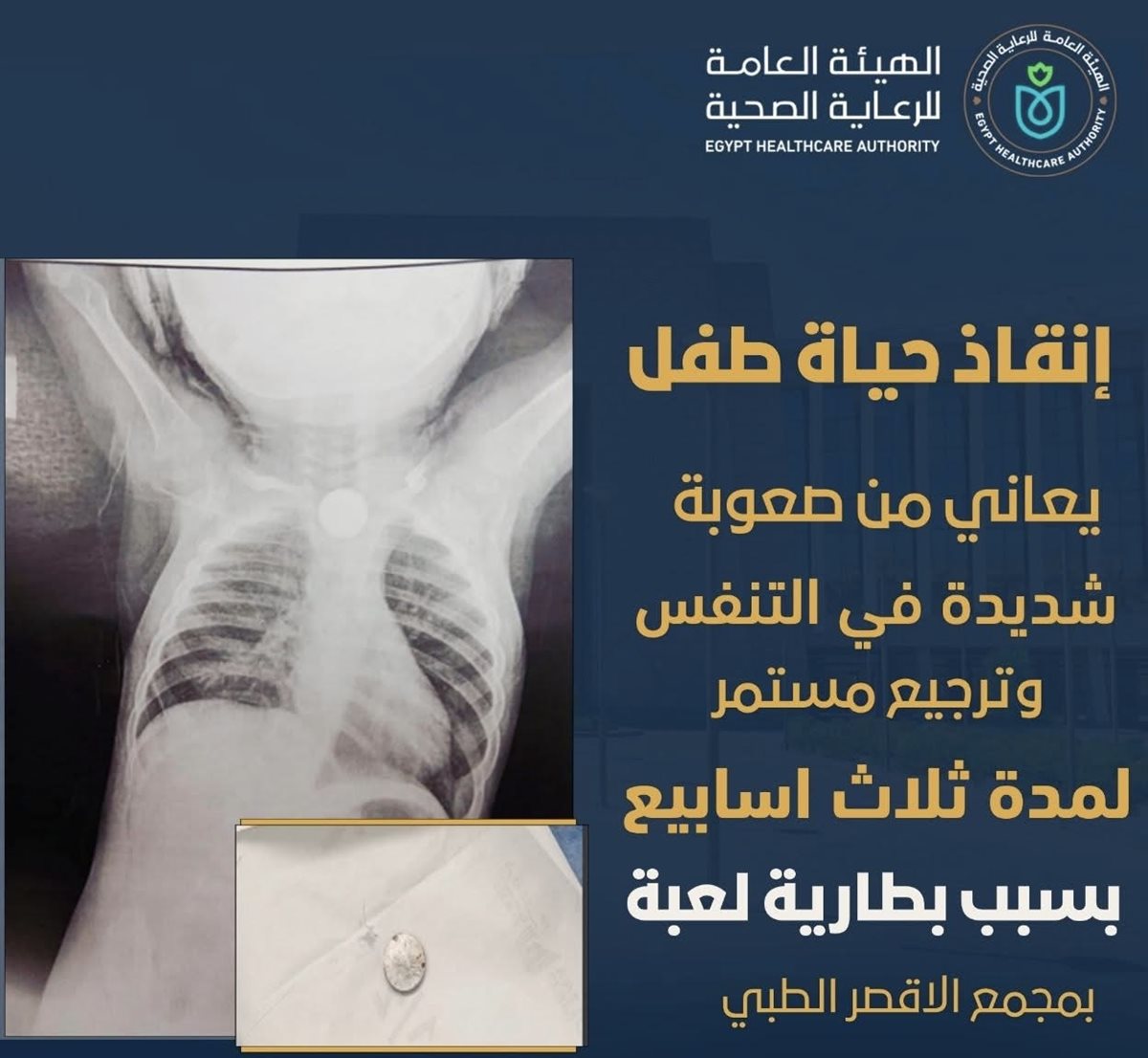 إنقاذ حياة صغير 