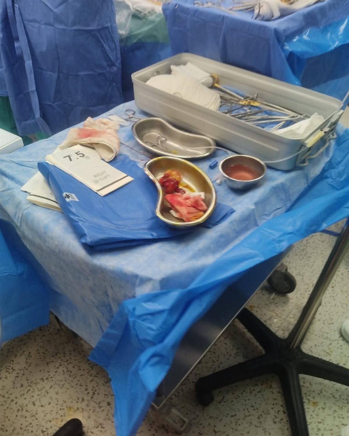 جراحة نادرة لاستئصال ورم بالقلب لأول مرة بمستشفى طامية المركزي في الفيوم