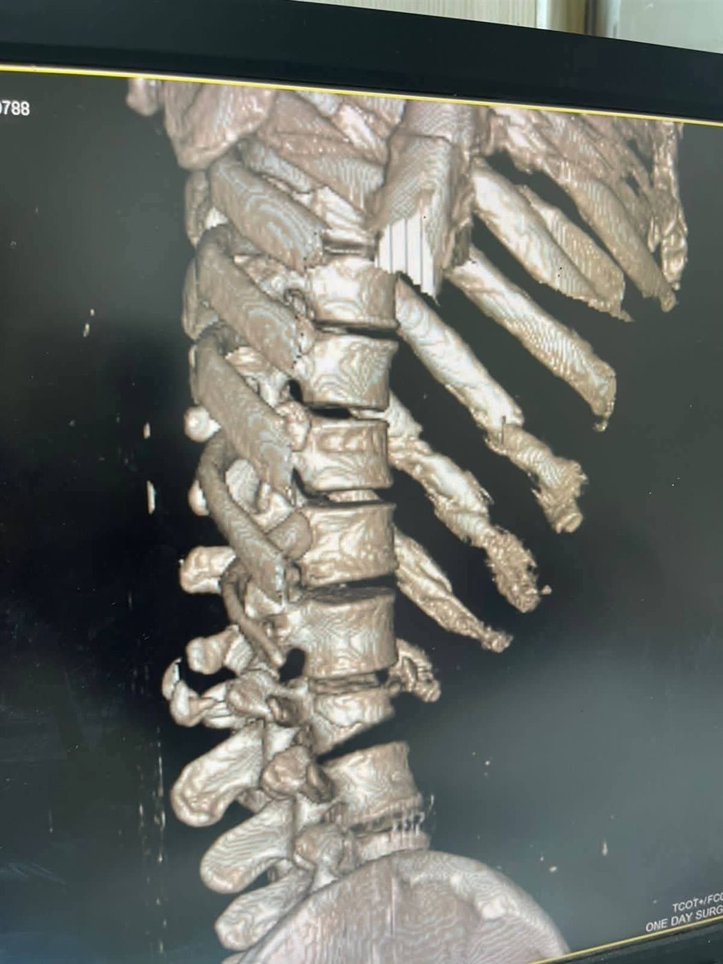 جانب من العملية 