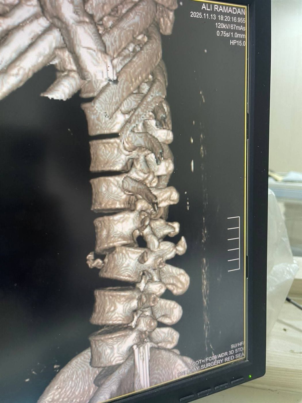 جانب من العملية 