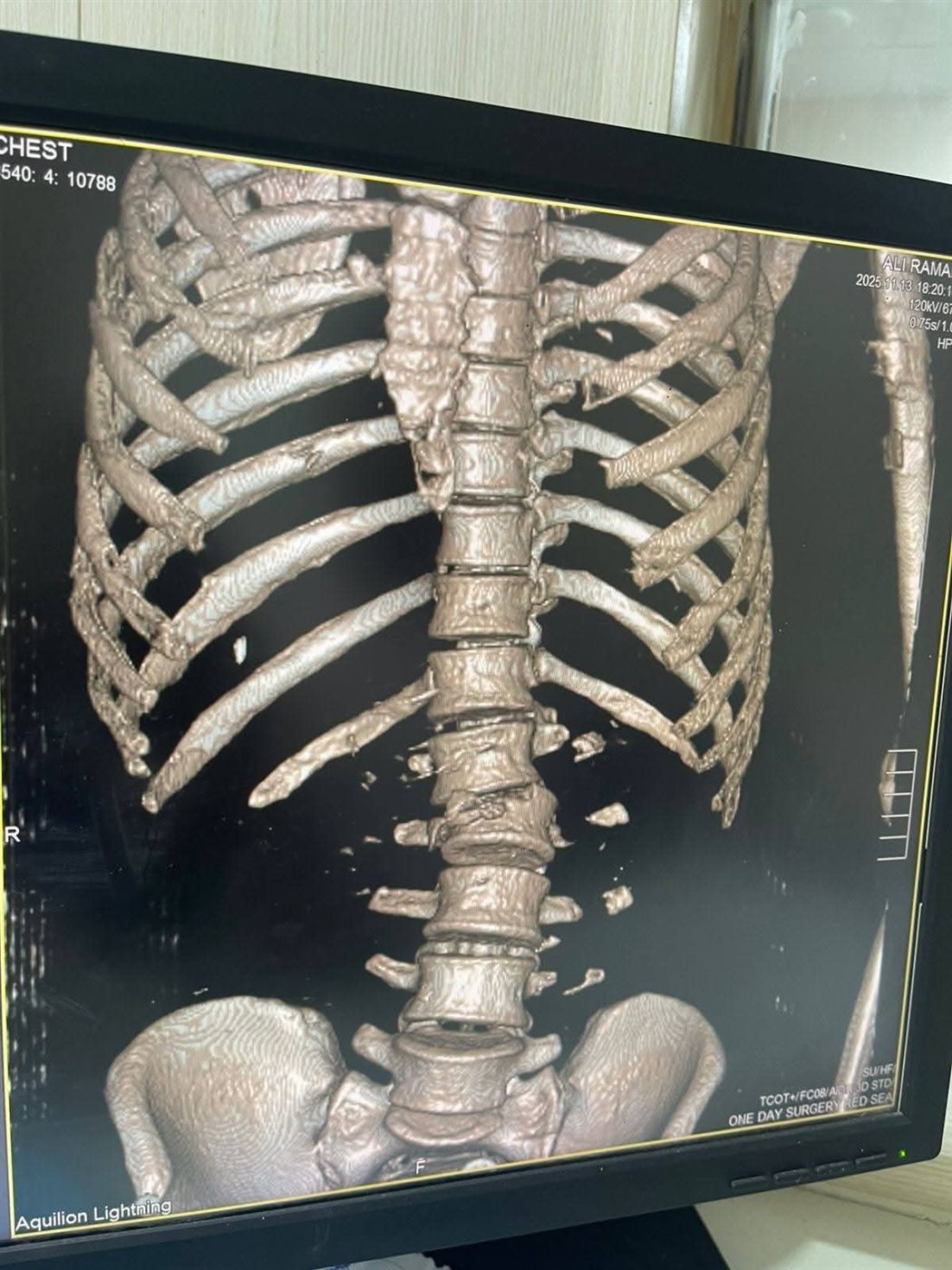 جانب من العملية 