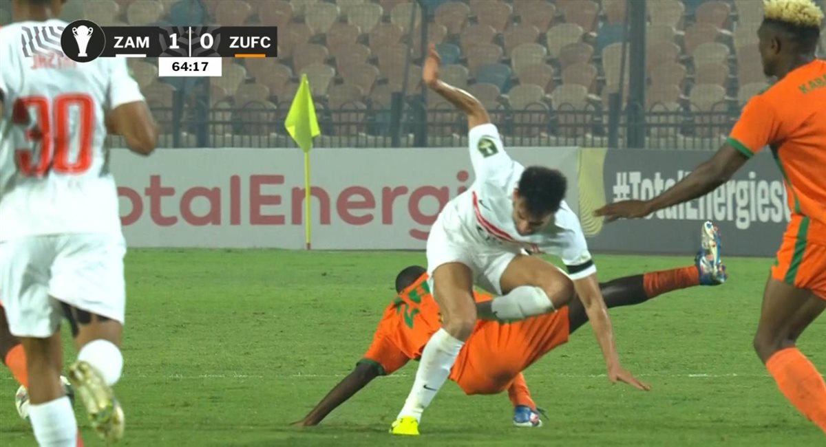<strong>إصابة نبيل عماد دونجا لاعب الزمالك في مباراة زيسكو في كأس الكونفدرالية الإفريقية</strong>