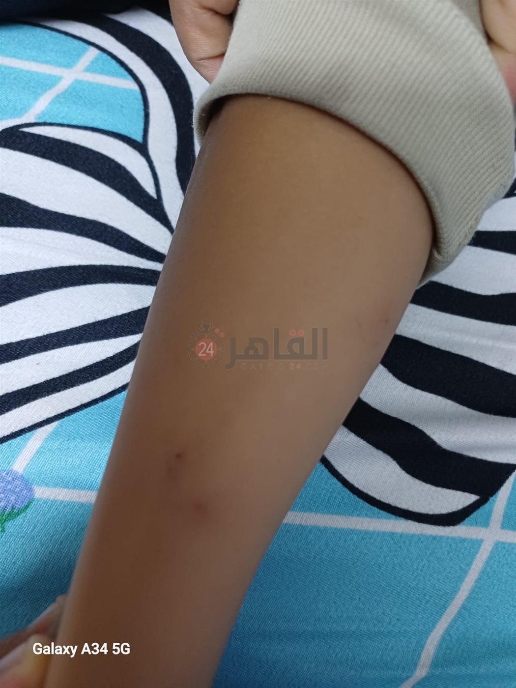  أولياء أمور مدرسة بالقاهرة يستغيثون من انتشار حشرات البق داخل الفصول 