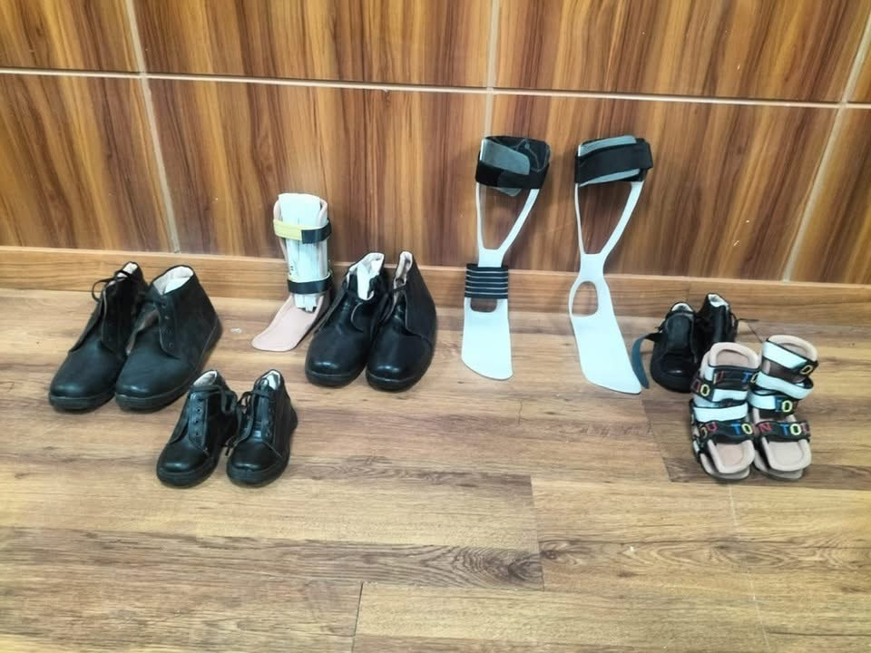 طفرة في تركيب الأطراف الصناعية بالأقصر