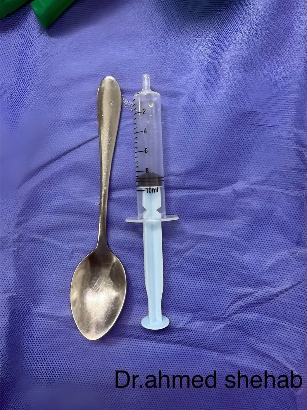 سيدة تبتلع معلقة شاي بالمنوفية