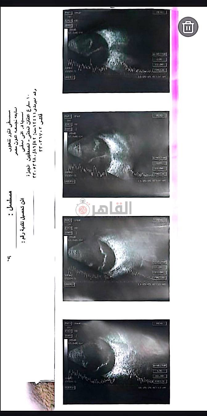 التقرير الطبي&nbsp;