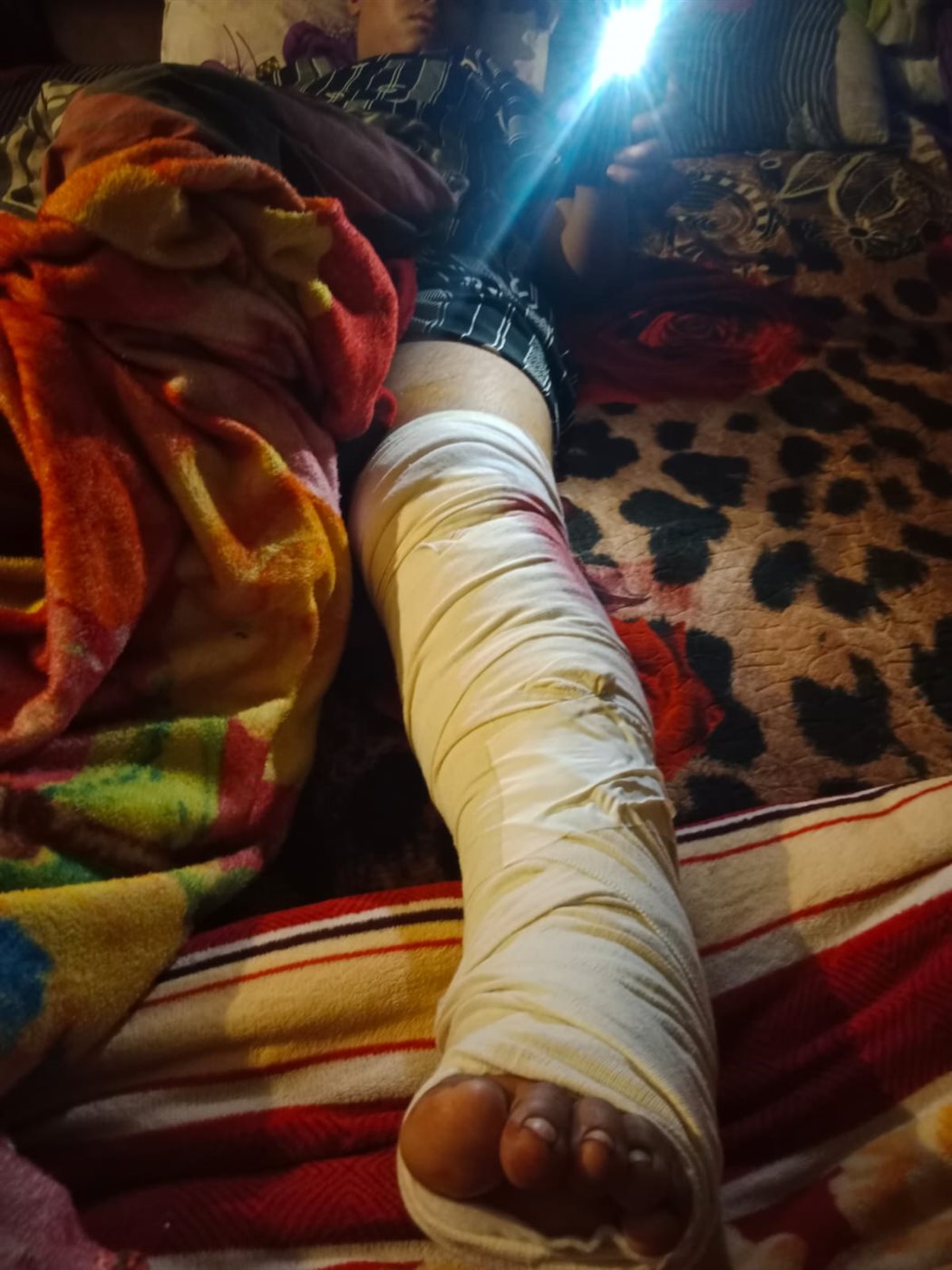 <strong>صورة الطفل بعد العملية الجراحية</strong>