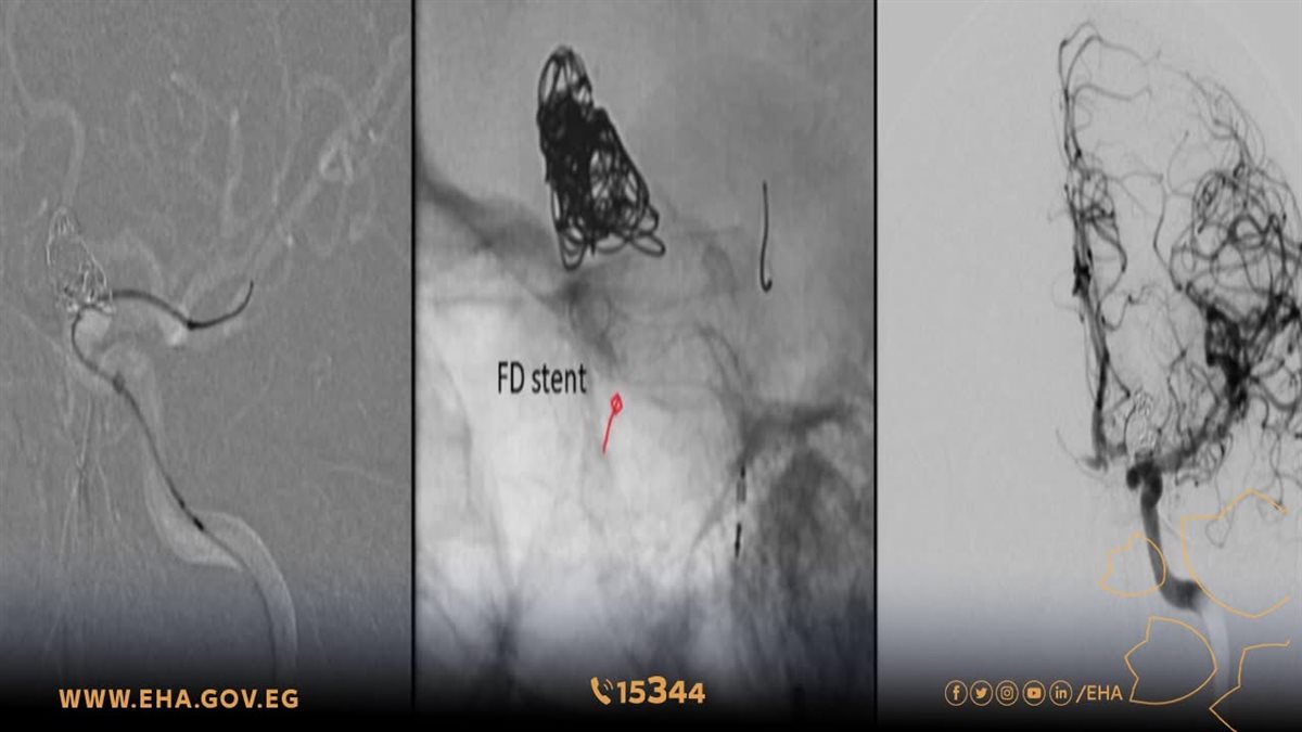 مستشفى إسنا&nbsp;