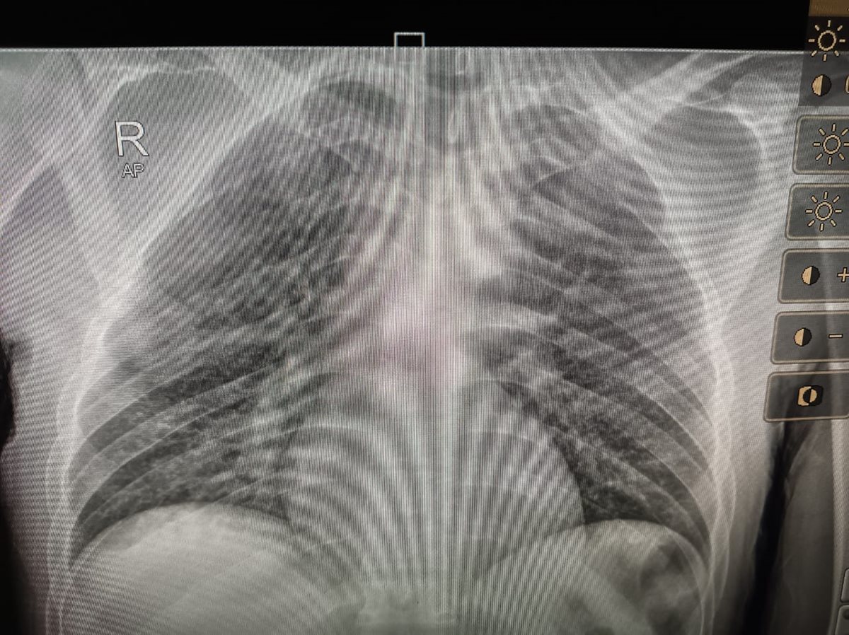 تقرير المريض