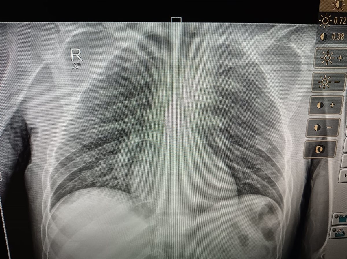 تقرير المريض