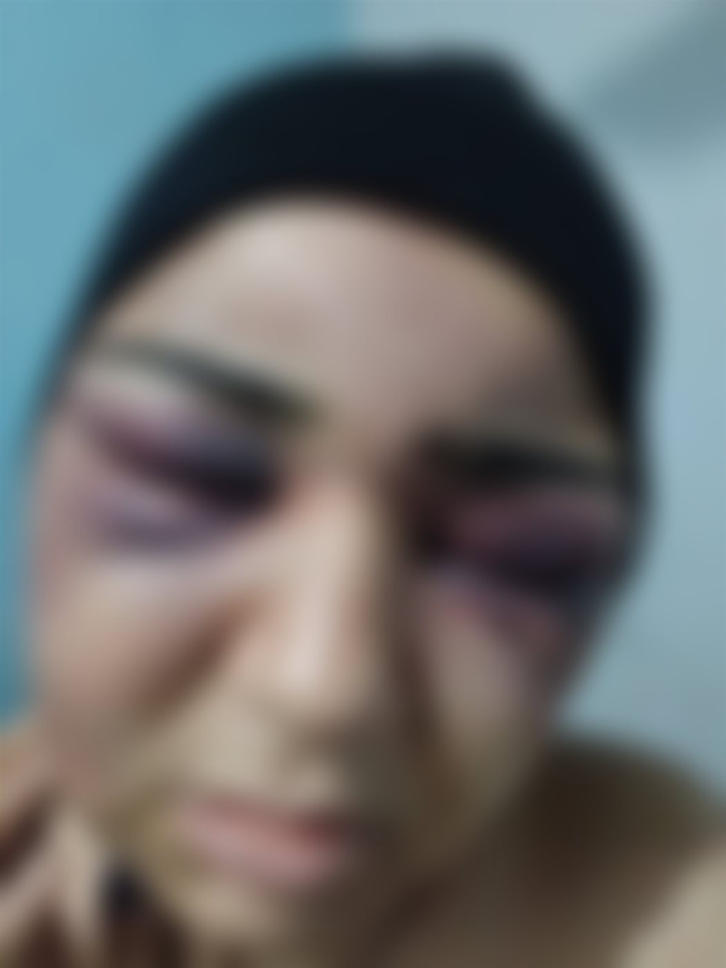 ضربها بحديدة.. زوج يعتدي بالضرب على زوجته بالفيوم