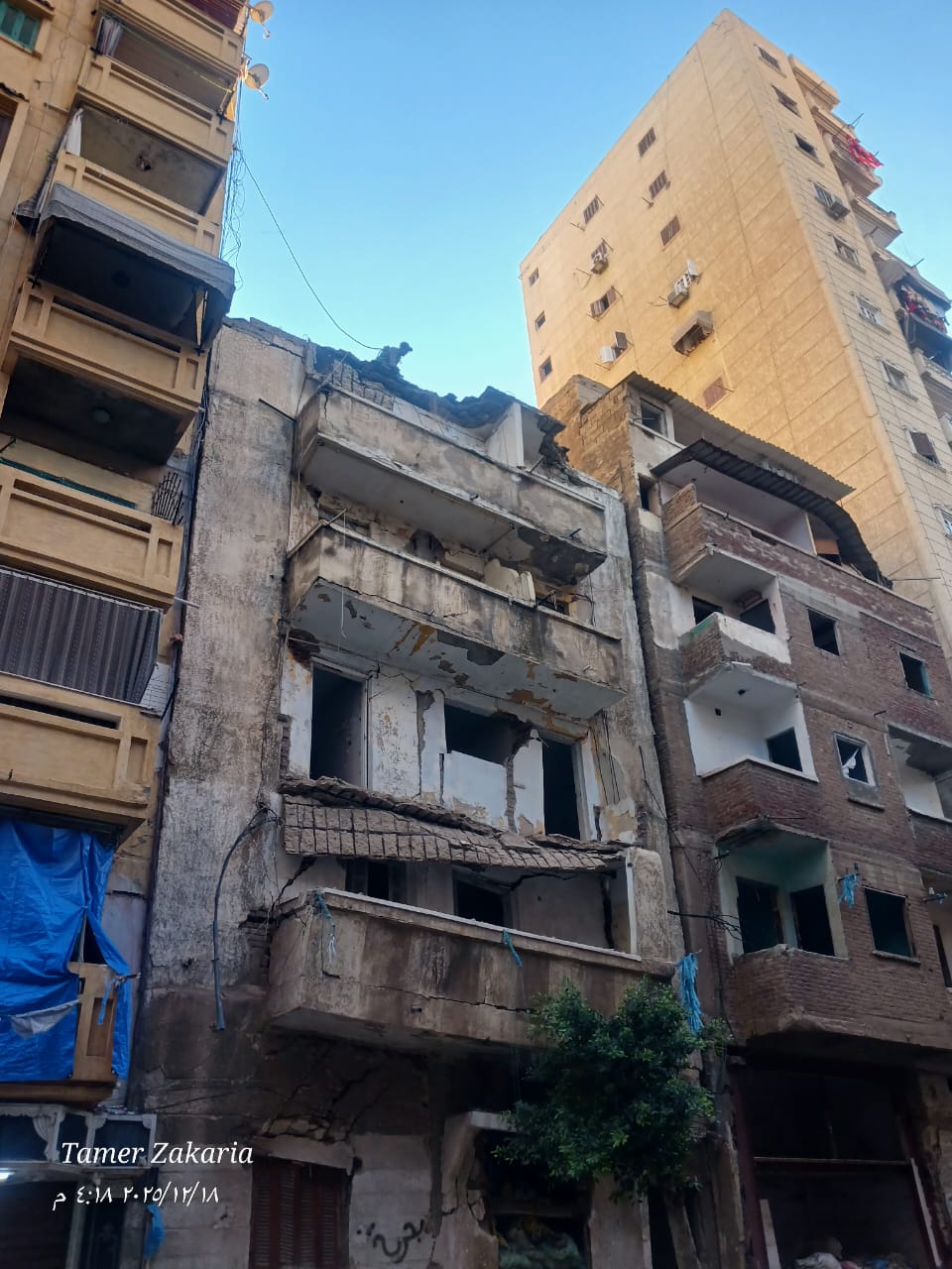 إزالة الأجزاء الخطر&nbsp;