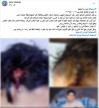 ضبط عامل تعدي علي شاب بعصا خشبية&nbsp;