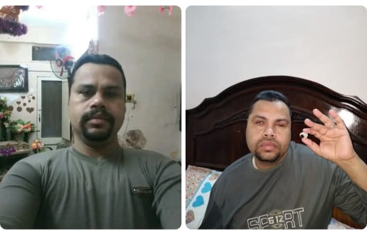 قبل وبعد الحادث