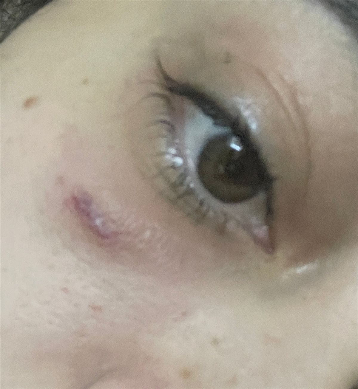 سيدة تستغيث بعد تعرضها لإهمال داخل عيادة تجميل