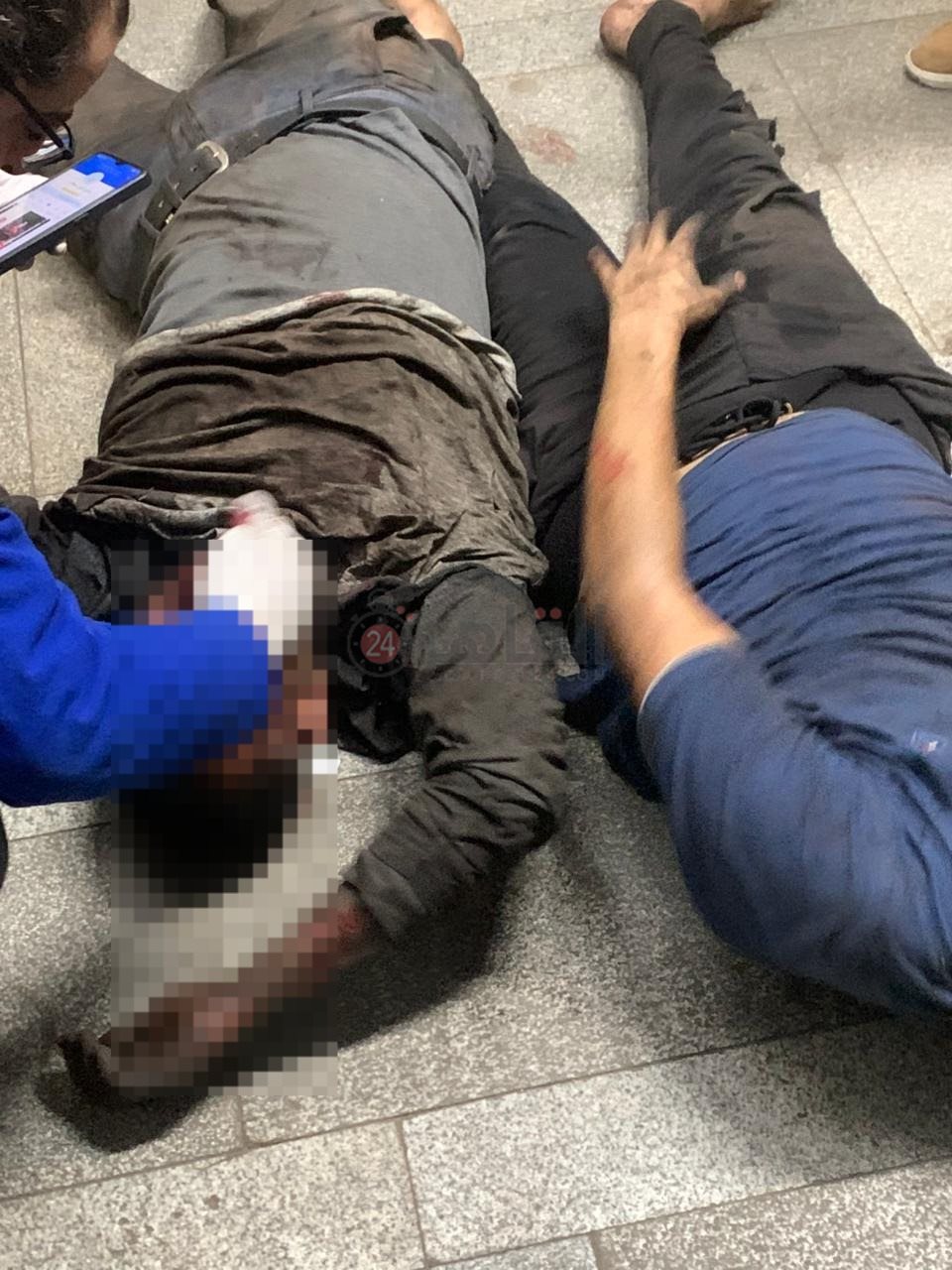 الصور الأولى لمصابي حادث سقوط أسانسير داخل مترو العتبة