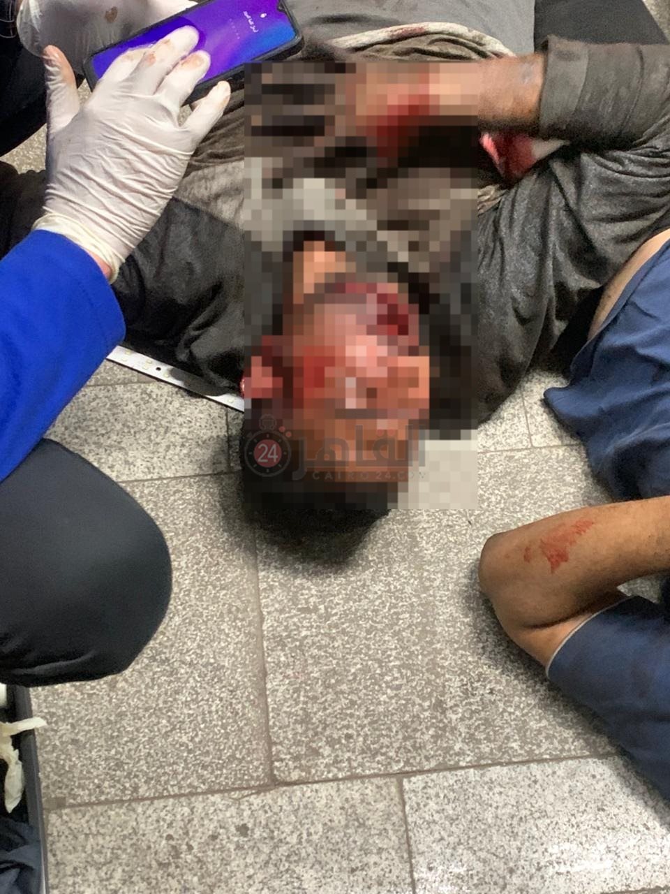 الصور الأولى لمصابي حادث سقوط أسانسير داخل مترو العتبة