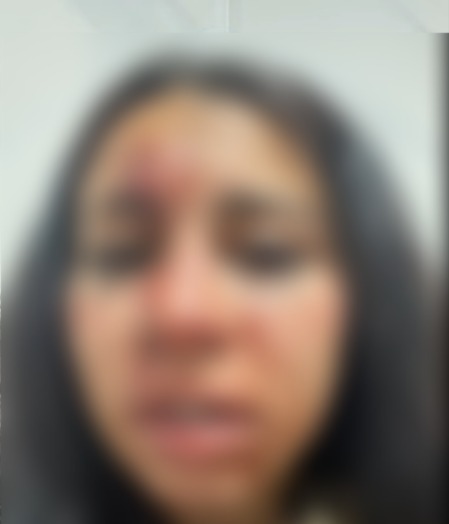 المجني عليها