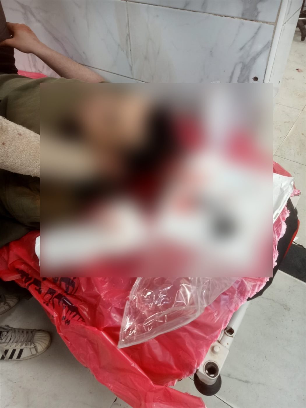 المصابين في واقعة الاعتداء بالأسلحة البيضاء&nbsp;