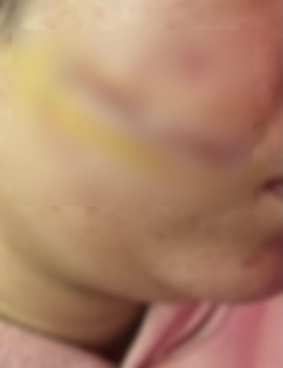 جانب من الاعتداء على الفتاة&nbsp;