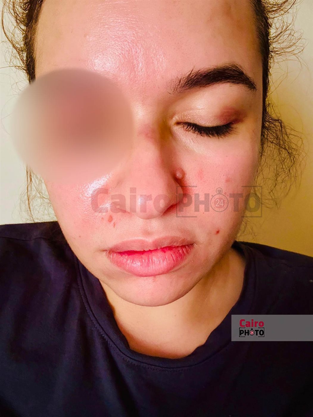 زوجة الفنان محمود حجازي بعد تعديه عليها بالضرب