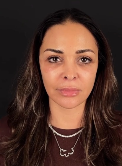 خضوع داليا البحيري لـ عملية شد الوجه والرقبة