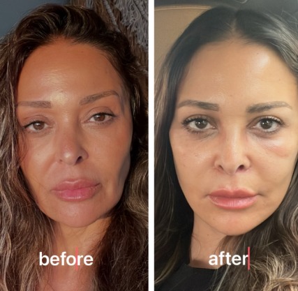 داليا البحيري قبل وبعد