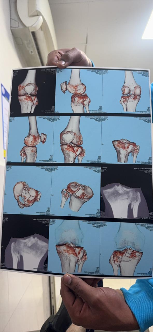 تفاصيل إصابة أحمد رمزي في الركبة