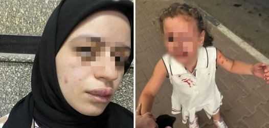سماء القاضي وابنتها بعد تعدي طليقها عليها بالضرب