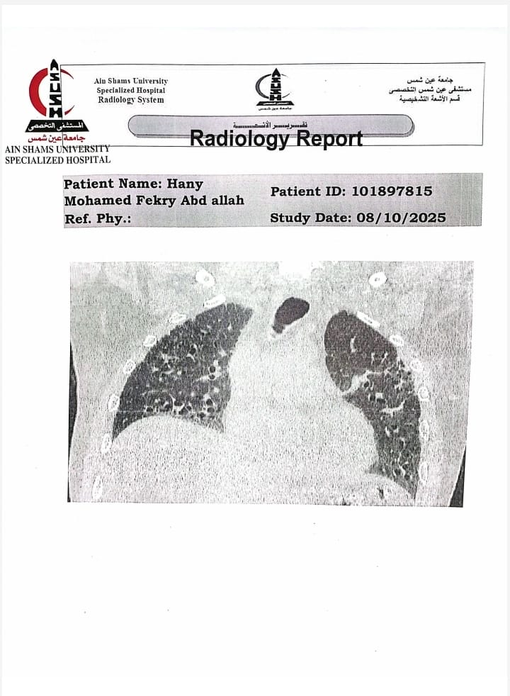 تقرير طبي بحالة هاني فكري مريض التليف الرئوي&nbsp;