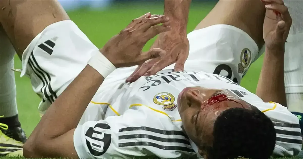 <strong>إصابة كيليان مبابي في مباراة ريال مدريد وجيرونا في الدوري الإسباني 2025 - 2026</strong>