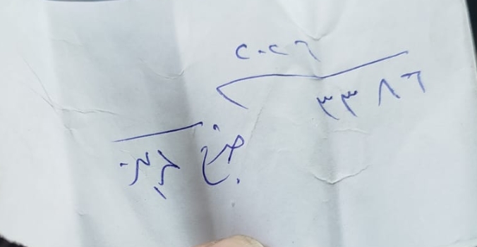 &nbsp;كلب يهاجم صغيرة 7 سنوات أثناء بروفة مسرحية ويصيبها بتشوهات خطيرة