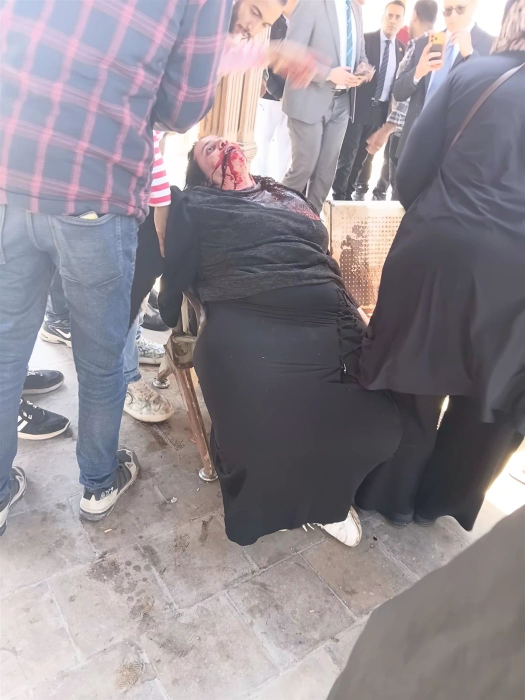 إصابة سيدة