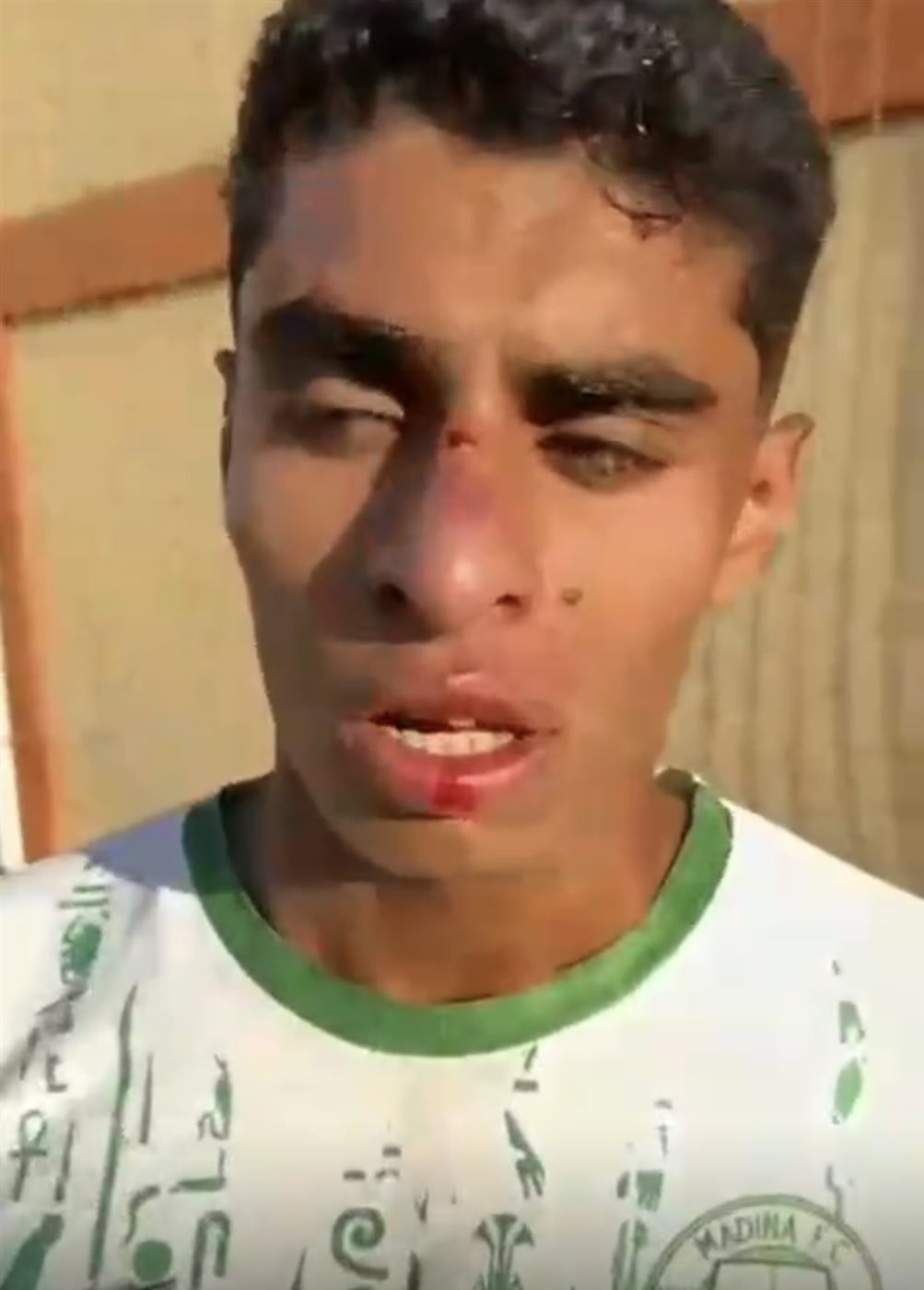 الاعتداء على لاعبي الأقصر&nbsp;