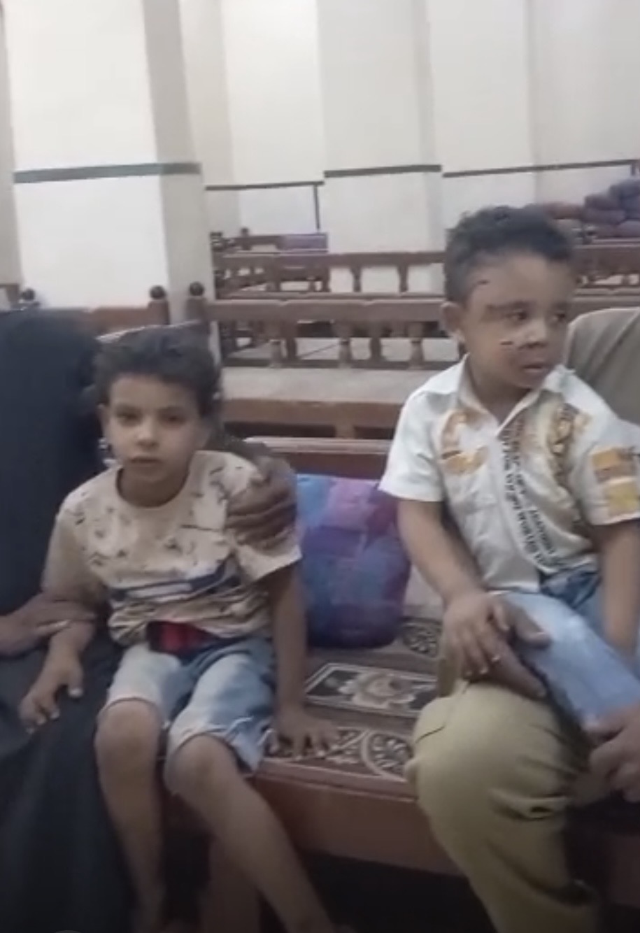 كلب ضال يعقر صغيرين بإسنا&nbsp;