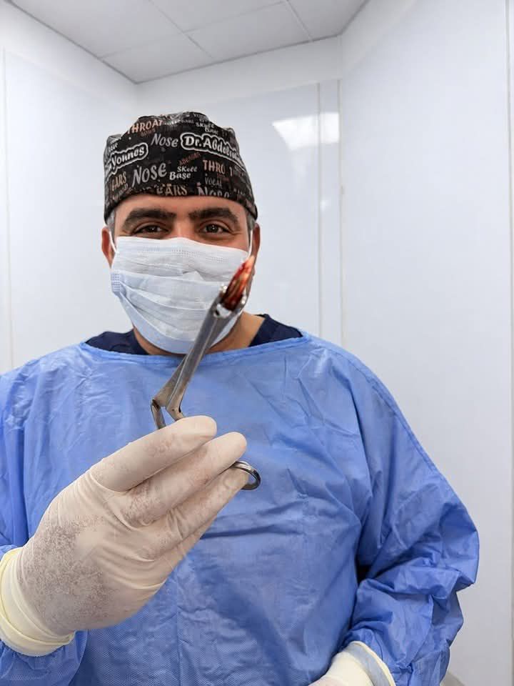 &nbsp;استخراج رصاصة غائرة من وجه مريض بالمنظار الضوئي&nbsp;
