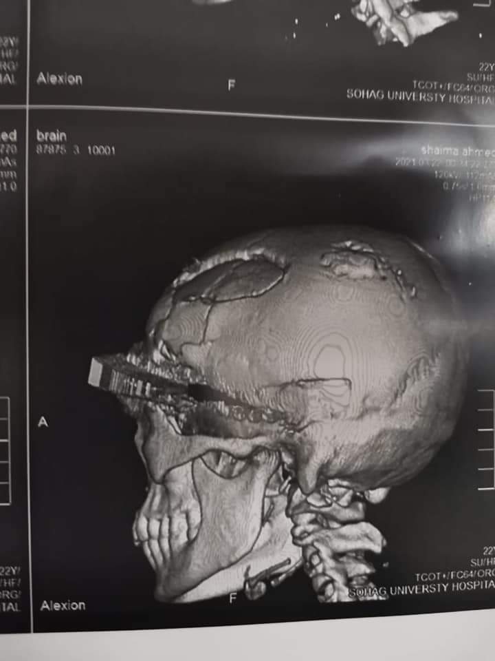 WhatsApp Image 2021-03-22 at 3.39.43 PM